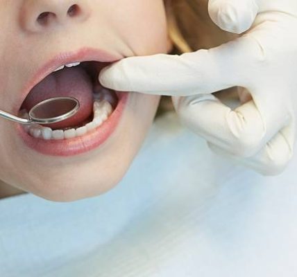 Choose Comprehensive Family Dental Services from a dentist abbotsford