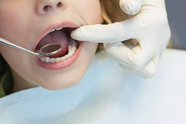 Choose Comprehensive Family Dental Services from a dentist abbotsford